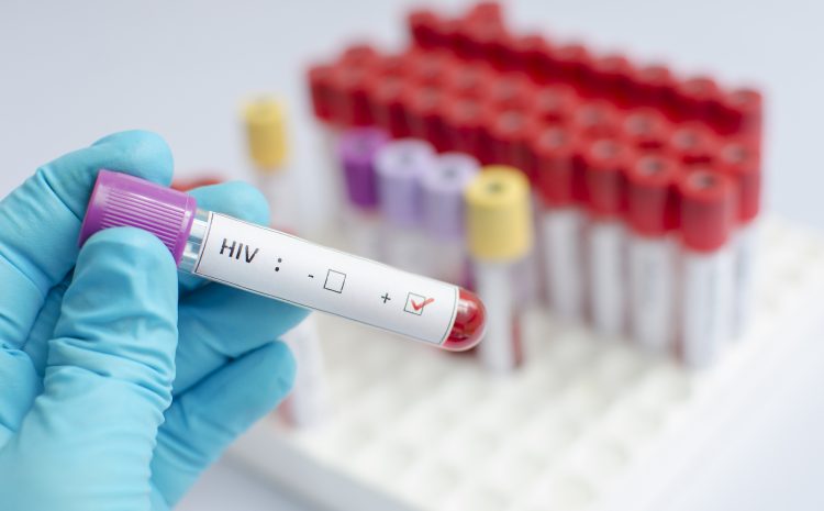  Empresa é condenada por exigir teste de HIV para contratação de garçom, decide TST