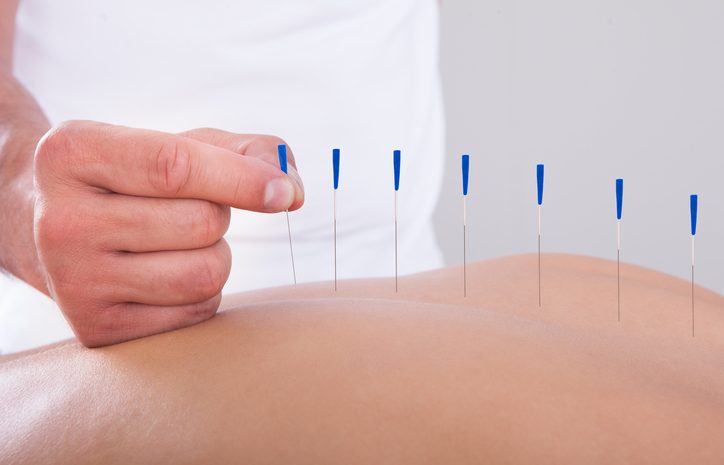  NÃO TEM PREVISÃO LEGAL: STJ confirma proibição da prática de acupuntura por educador físico